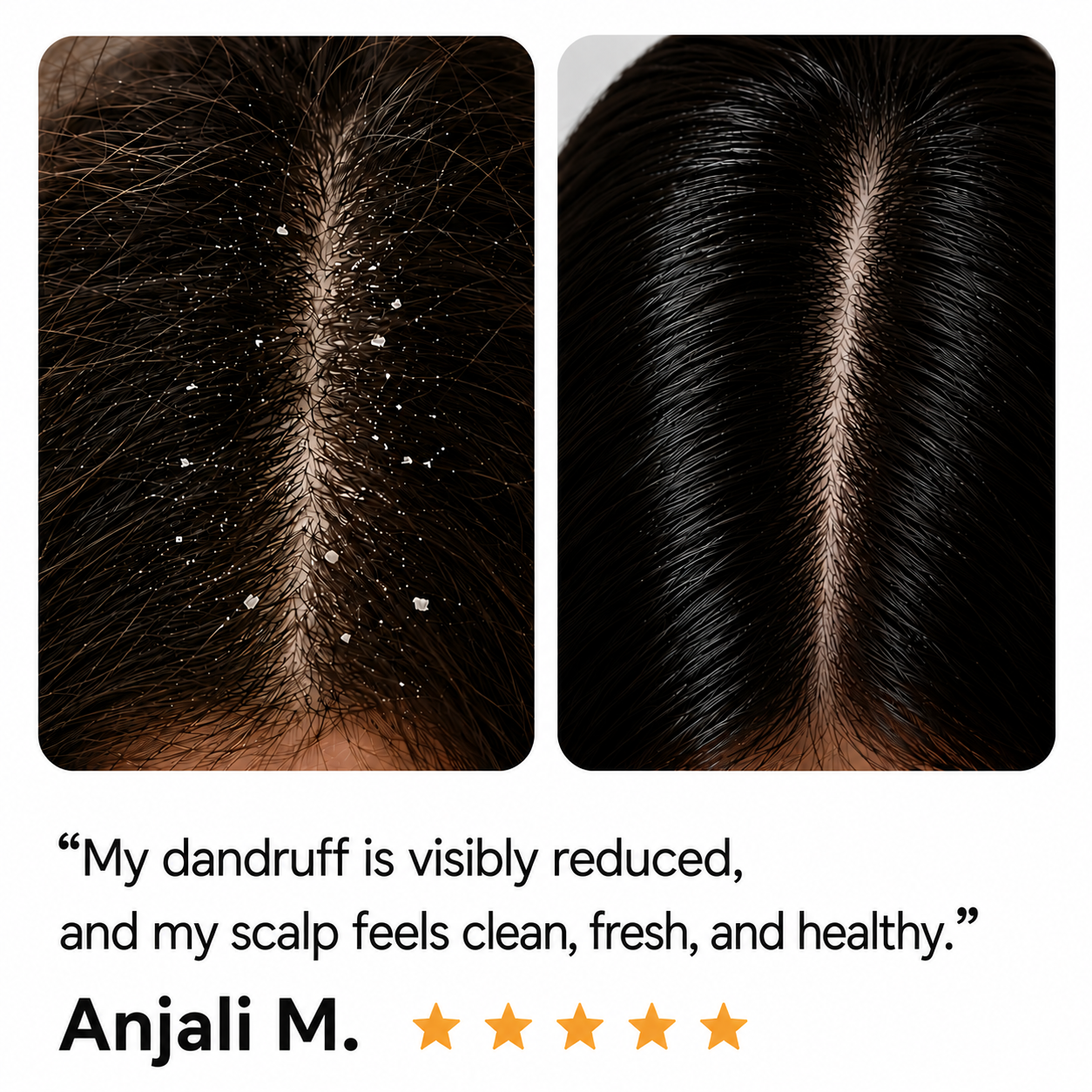 Dandruff free