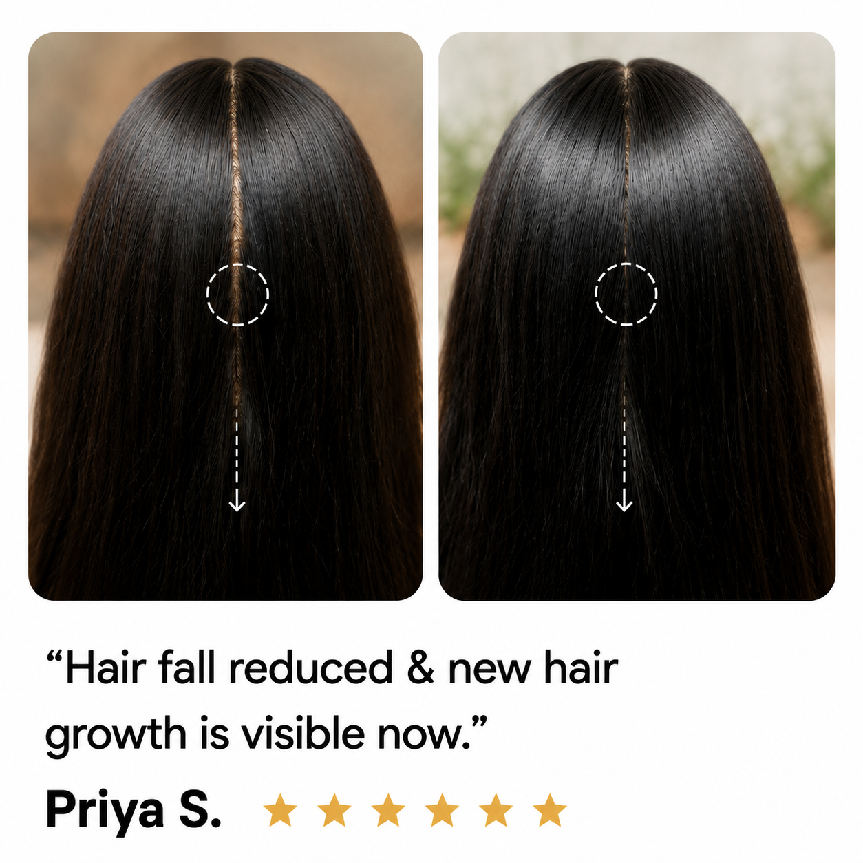 Hair growth